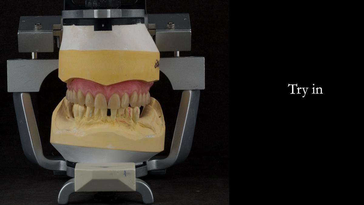 Newsletter 87 – Father Peter: A Partial Denture that needed Minor Miracle