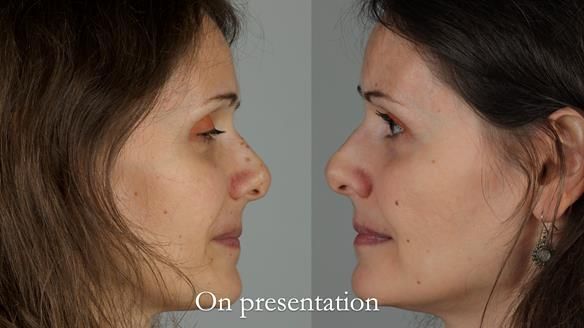 Newsletter 79 – Creating a wonderful smile and changing a life.