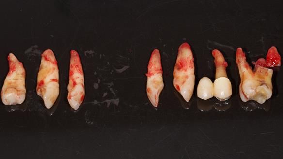 Newsletter 79 – Creating a wonderful smile and changing a life.