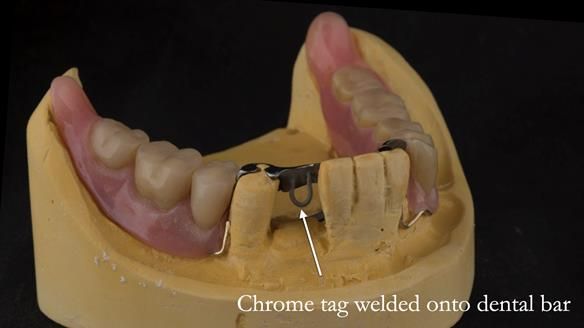 Ken – going downhill, first class