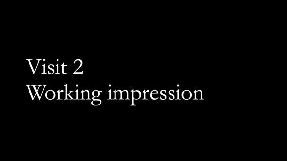 Finlay's Newsletter 60 Sylvia's upper Kennedy Class 2 Mod 1 metal based upper RPD