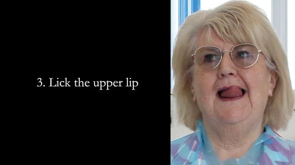 Replacing Madeline’s Complete denture FULL PROTOCOL