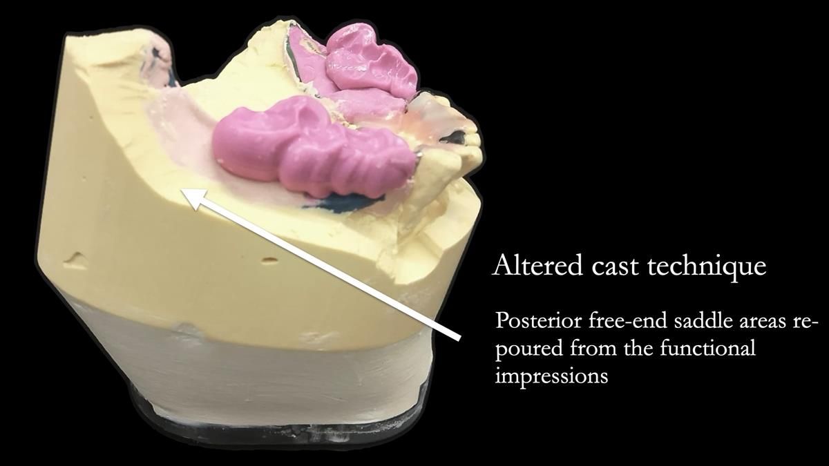 Newsletter 87 – Father Peter: A Partial Denture that needed Minor Miracle