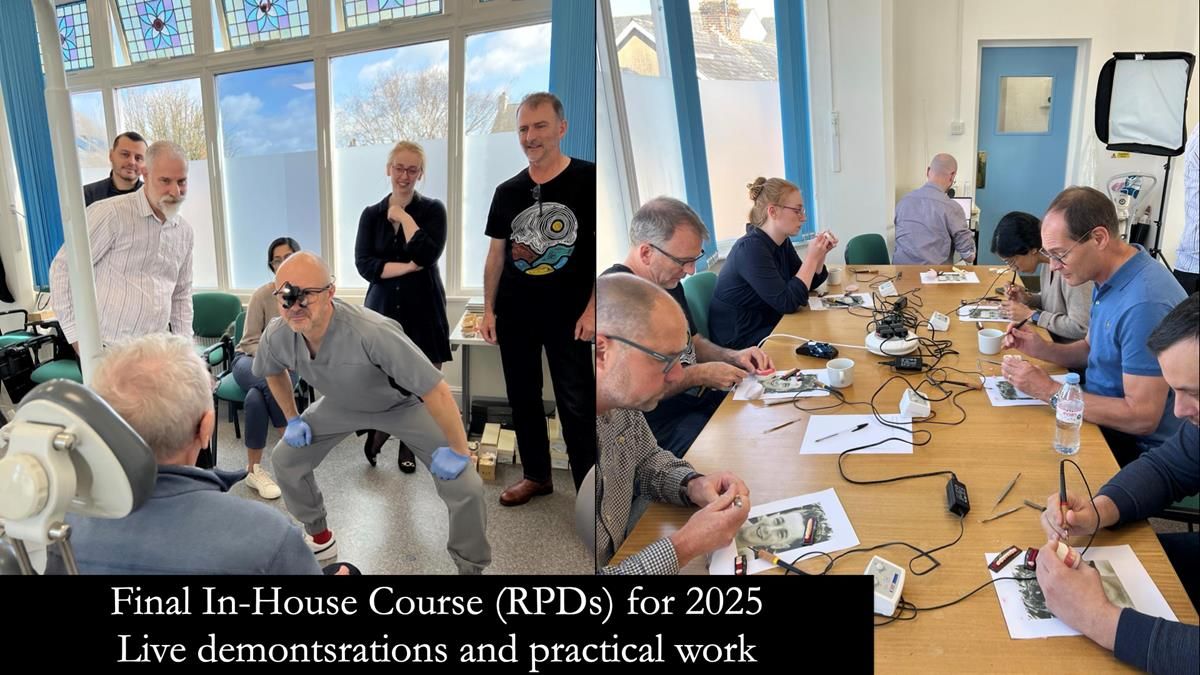 Newsletter 81 - Pam’s Story — how a partial denture changed her life (+ live walkthrough this Thursday)