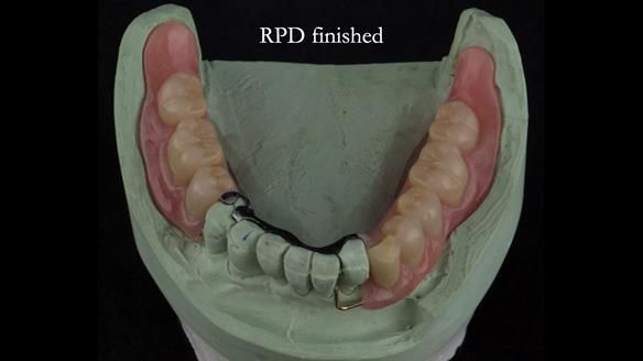 Ken – going downhill, first class