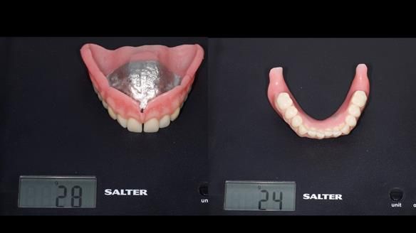 Newsletter 78: What do Clark Gable and a Locator® overdenture have in common?