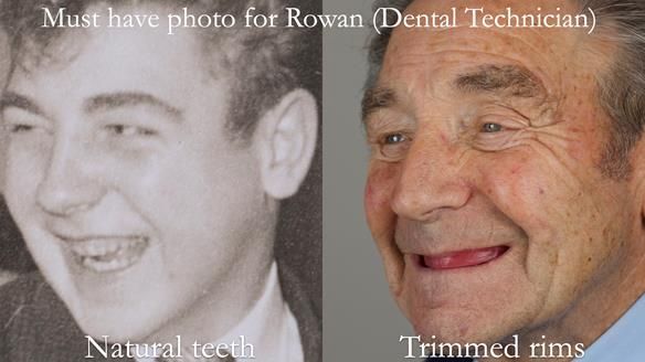 Newsletter 50 Special edition Complete Dentures FULL PROTOCOL