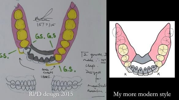 Ken – going downhill, first class