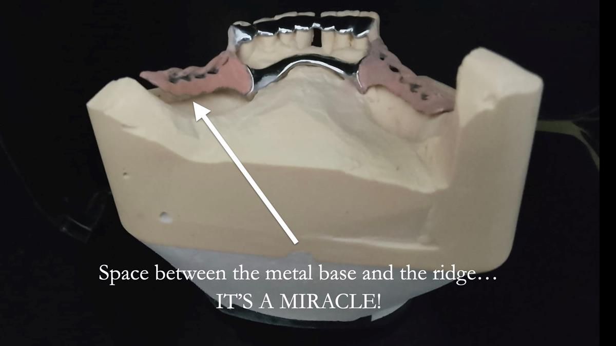 Newsletter 87 – Father Peter: A Partial Denture that needed Minor Miracle