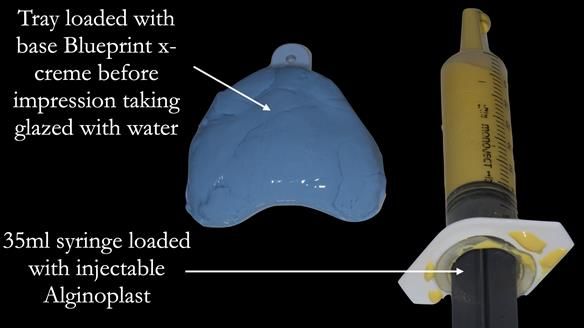 Newsletter 52 Managing Jo’s failing dentition with extractions and Mk 1/Mk 2 complete upper dentures and lower partial dentures FULL PROTOCOL