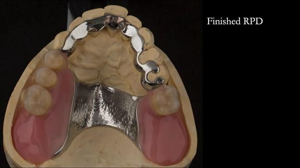 Ken – going downhill, first class