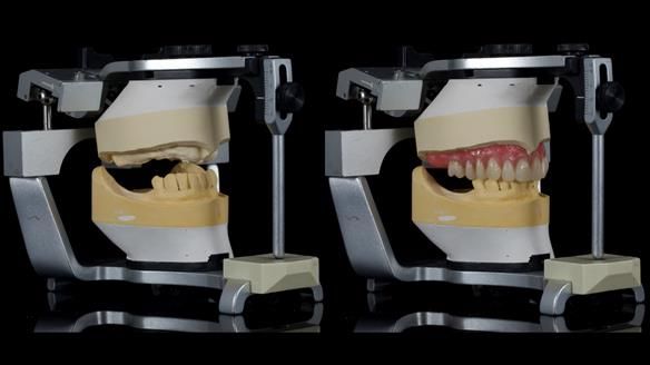 Newsletter 79 – Creating a wonderful smile and changing a life.