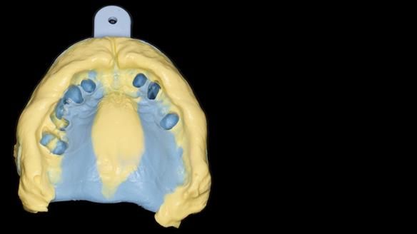 Newsletter 79 – Creating a wonderful smile and changing a life.