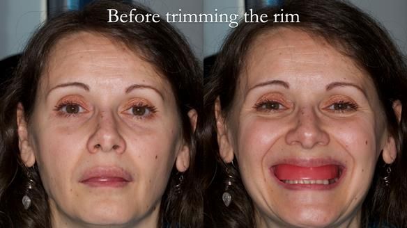 Newsletter 79 – Creating a wonderful smile and changing a life.