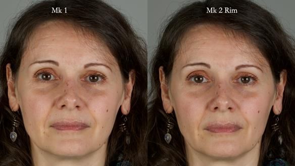 Newsletter 79 – Creating a wonderful smile and changing a life.