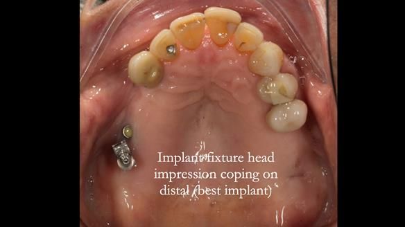 Ken – going downhill, first class