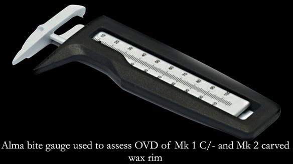 Newsletter 52 Managing Jo’s failing dentition with extractions and Mk 1/Mk 2 complete upper dentures and lower partial dentures FULL PROTOCOL