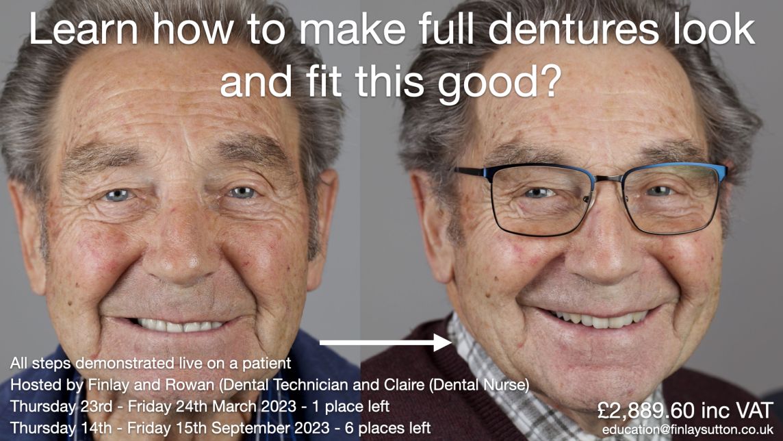 Complete denture course - 2 days with Finlay and Rowan