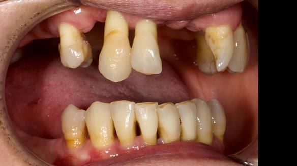 Newsletter 79 – Creating a wonderful smile and changing a life.