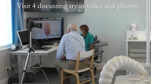 Complete denture Class II div 2 deep overbite Newsletter 39