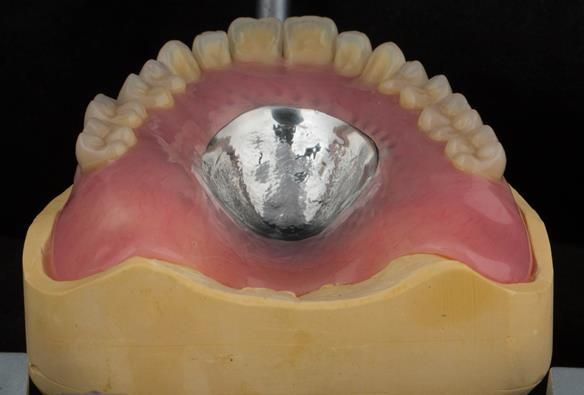 Figure 103 Mk 2 maxillary based denture with acrylic post dam which I find results in increased suction (retention) and enables relining in the future should this be needed