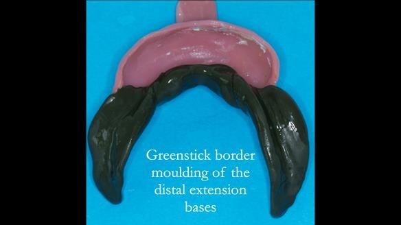 Ken – going downhill, first class