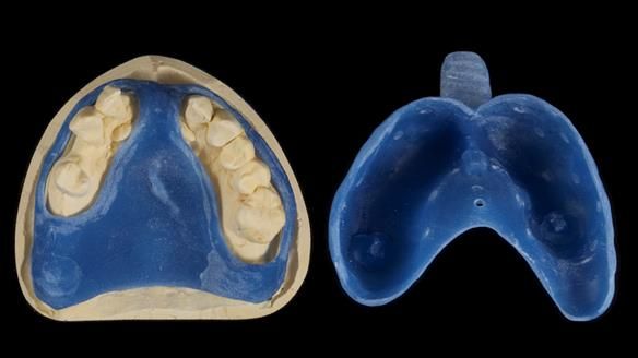 Newsletter 79 – Creating a wonderful smile and changing a life.