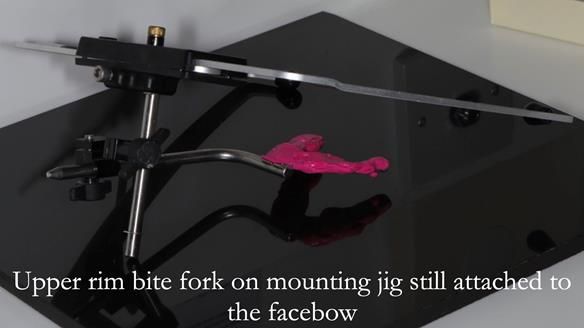 Finlay's Newsletter 58 Gasket upper partial denture for Zoe