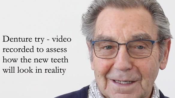 Newsletter 50 Special edition Complete Dentures FULL PROTOCOL