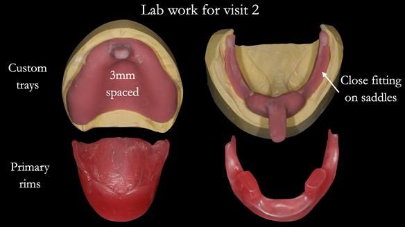 Technical work provided by Rowan for treatment visit 2