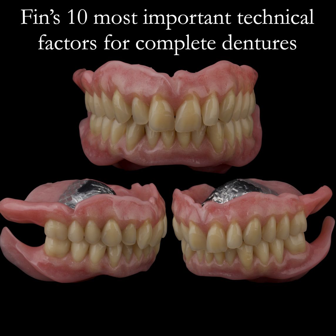 My 10 most important technical factors in producing complete dentures with superb aesthetics and function