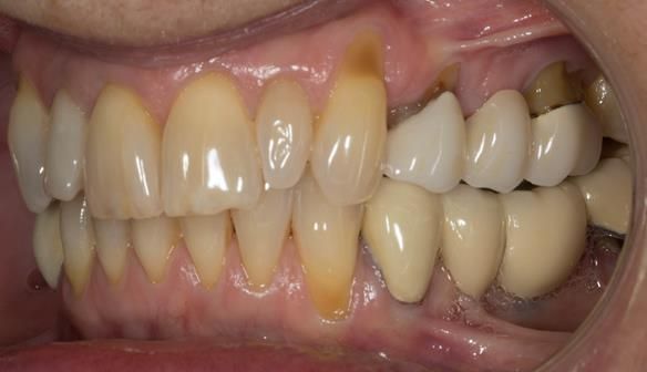 Figure 5 Pre - treatment.