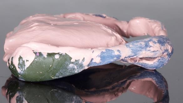 Newsletter 79 – Creating a wonderful smile and changing a life.