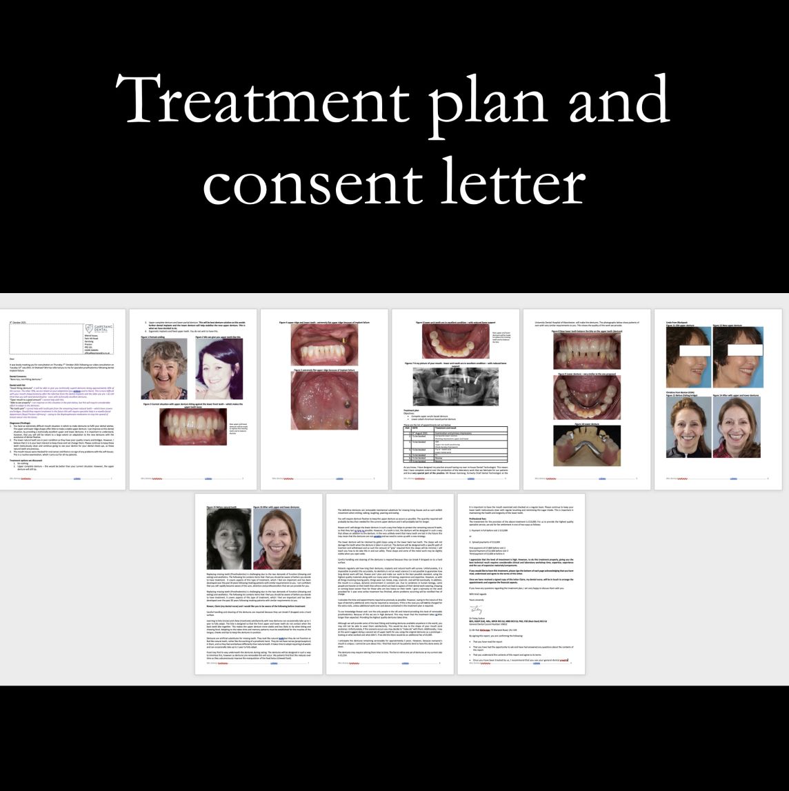 Consent letter – containing all factors a patient should be aware of before treatment