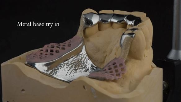 Ken – going downhill, first class