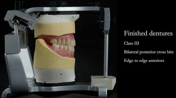 Finished dentures