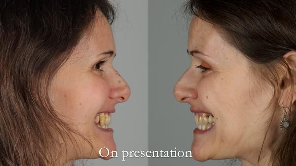 Newsletter 79 – Creating a wonderful smile and changing a life.