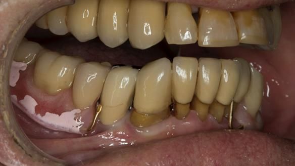 Ken – going downhill, first class