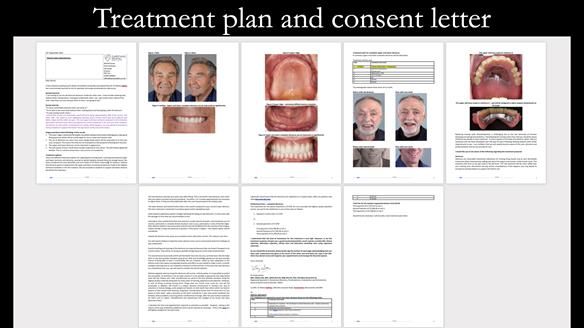 Newsletter 50 Special edition Complete Dentures FULL PROTOCOL