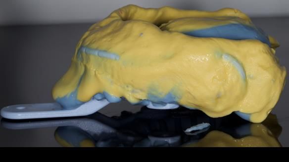 Newsletter 79 – Creating a wonderful smile and changing a life.