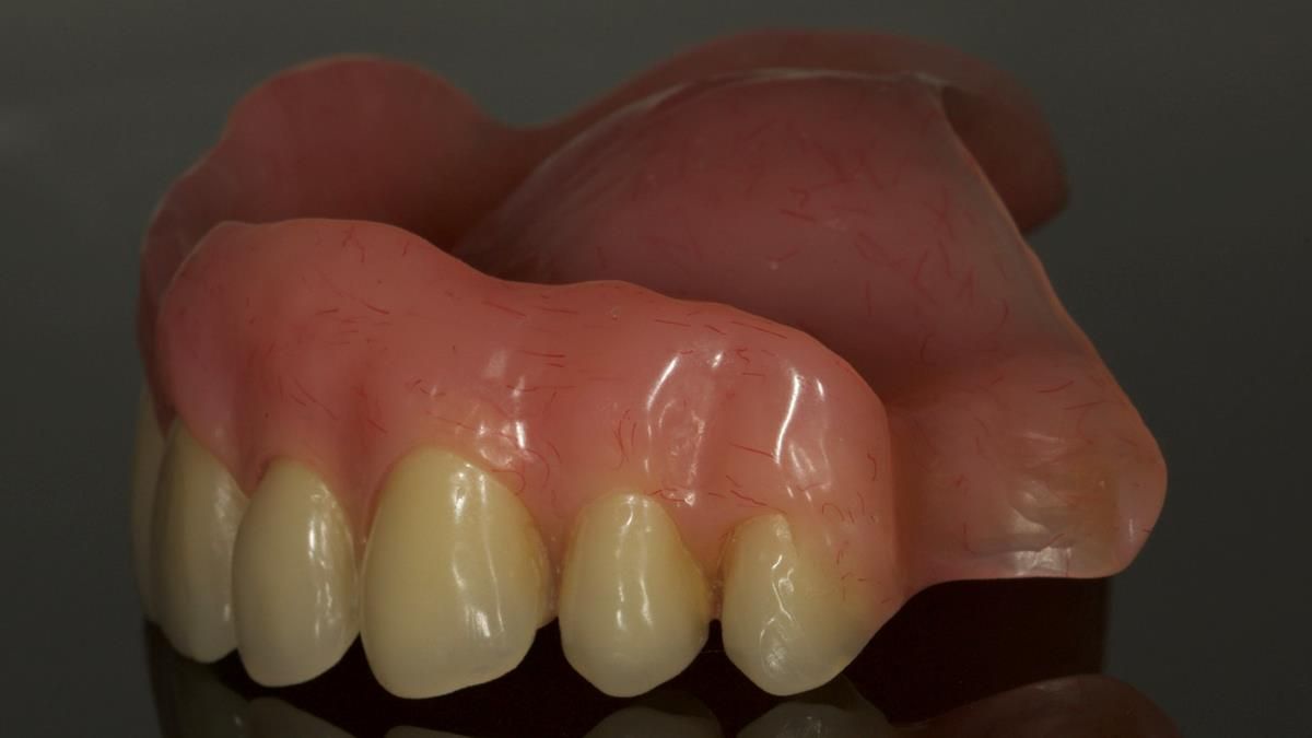 Newsletter 87 – Father Peter: A Partial Denture that needed Minor Miracle