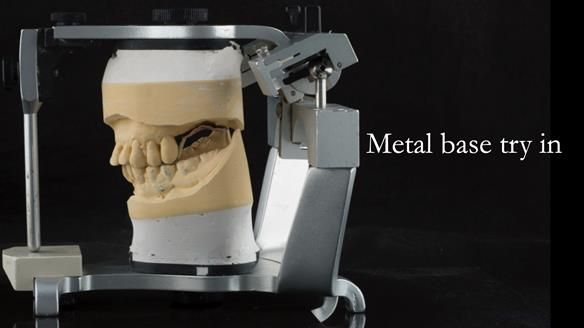 Ken – going downhill, first class