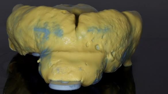 Newsletter 79 – Creating a wonderful smile and changing a life.