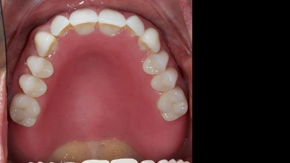Newsletter 79 – Creating a wonderful smile and changing a life.