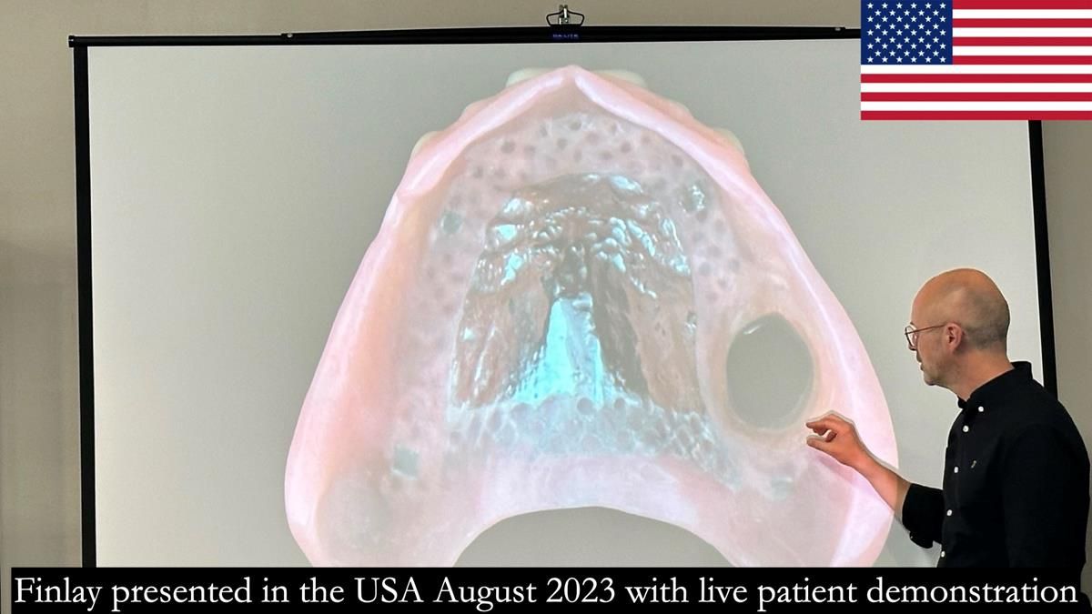 Finlay's Newsletter 58 Gasket upper partial denture for Zoe