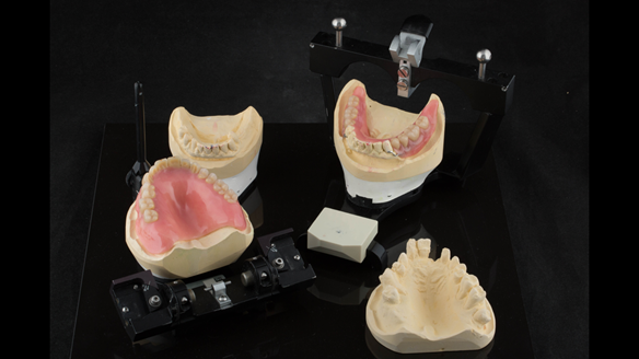 Figure 38 Mk1 immediate acrylic based dentures ready for fitting at visit 2