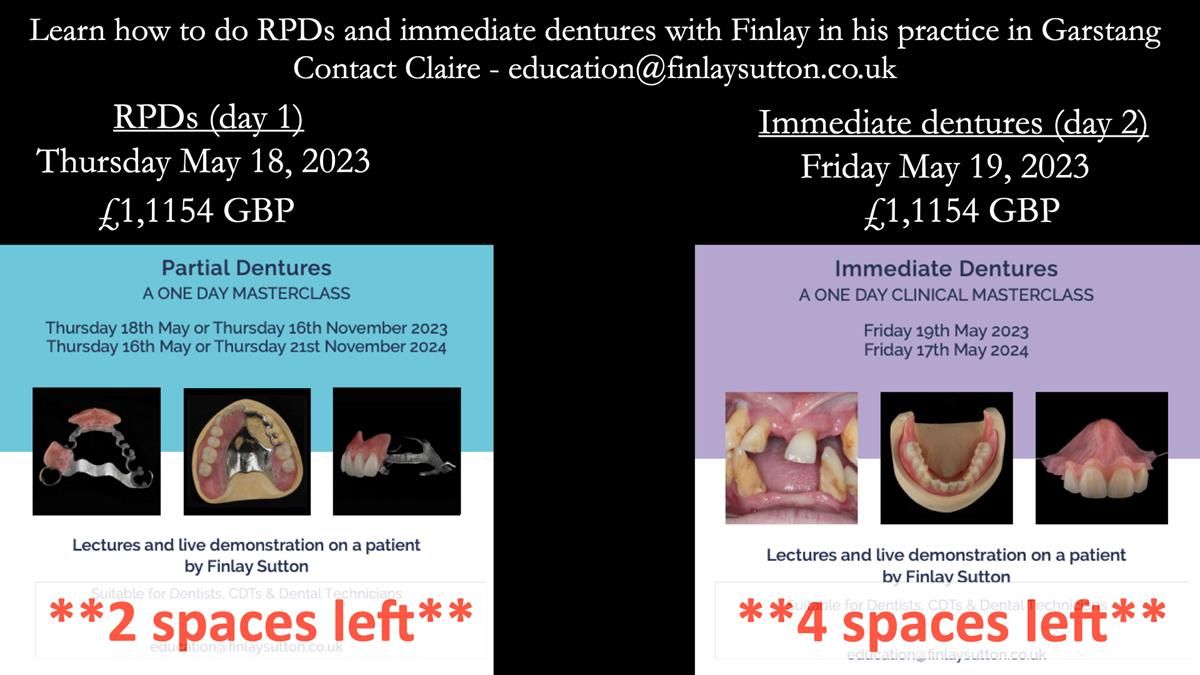 Newsletter 51 Managing Anne’s failing dentition with distal extension base RPD/Splint FULL PROTOCOL