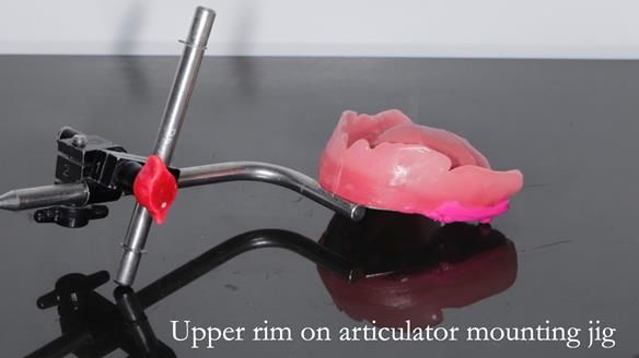 Newsletter 50 Special edition Complete Dentures FULL PROTOCOL