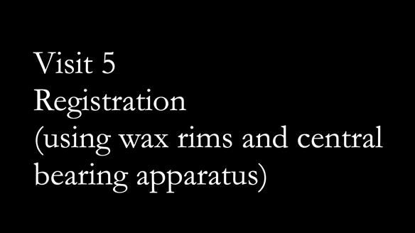 Finlay's Newsletter 62 provision of extractions and metal based complete dentures for Rafique