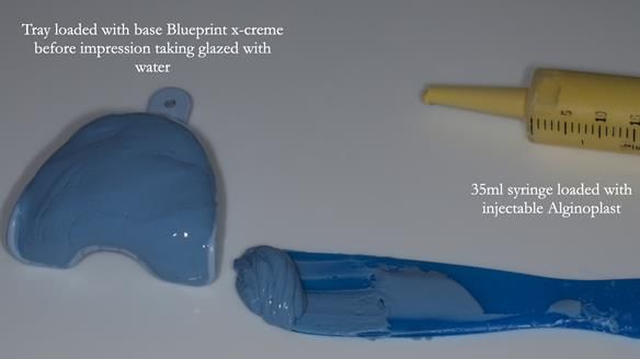 Newsletter 81 - Pam’s Story — how a partial denture changed her life (+ live walkthrough this Thursday)